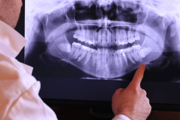 Best Emergency Dental Surgery in Martinsville, VA