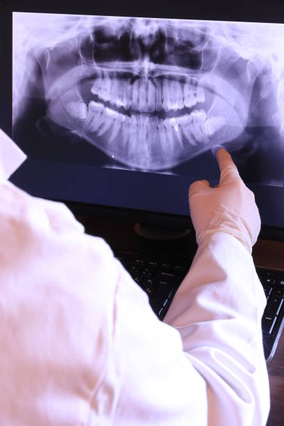 Best Emergency Treatment for Toothache in Martinsville, VA